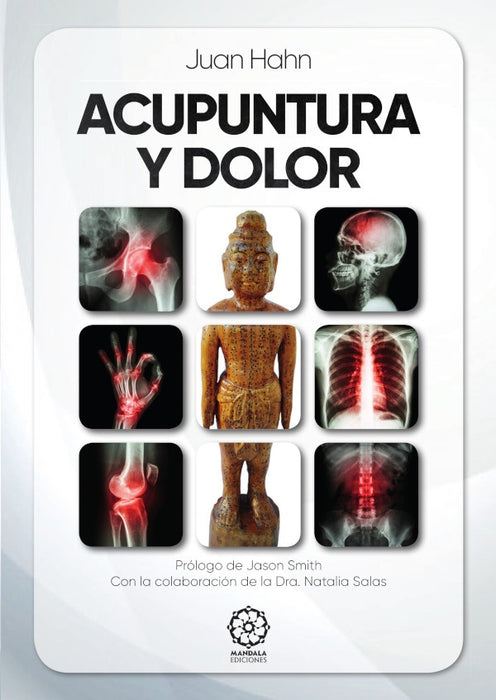 Acupuntura y dolor  | Fernando Cabal