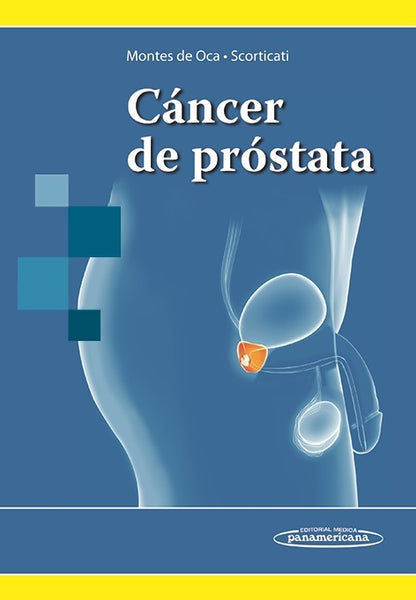 CANCER DE PROSTATA.. | MONTES DE OCA